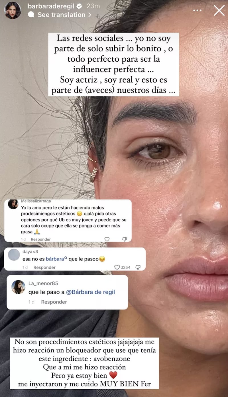 Bárbara de Regil muestra su rostro 'deformado' y preocupa a los fans