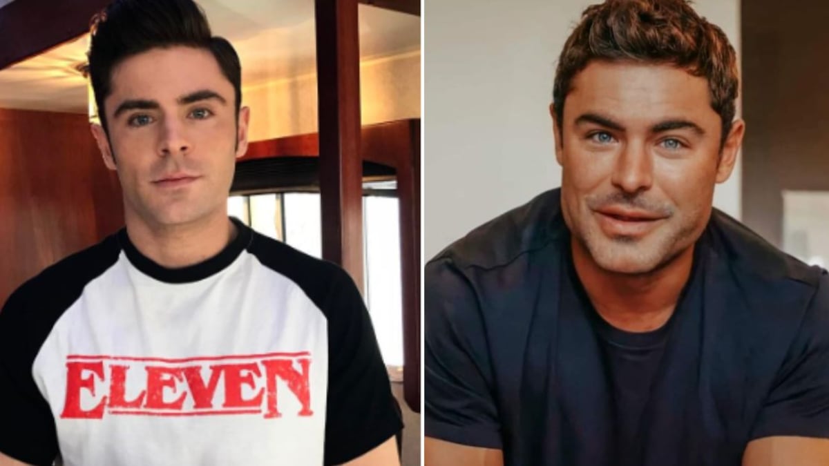 Zac Efron reveló que sufrió un grave accidente que afectó su rostro