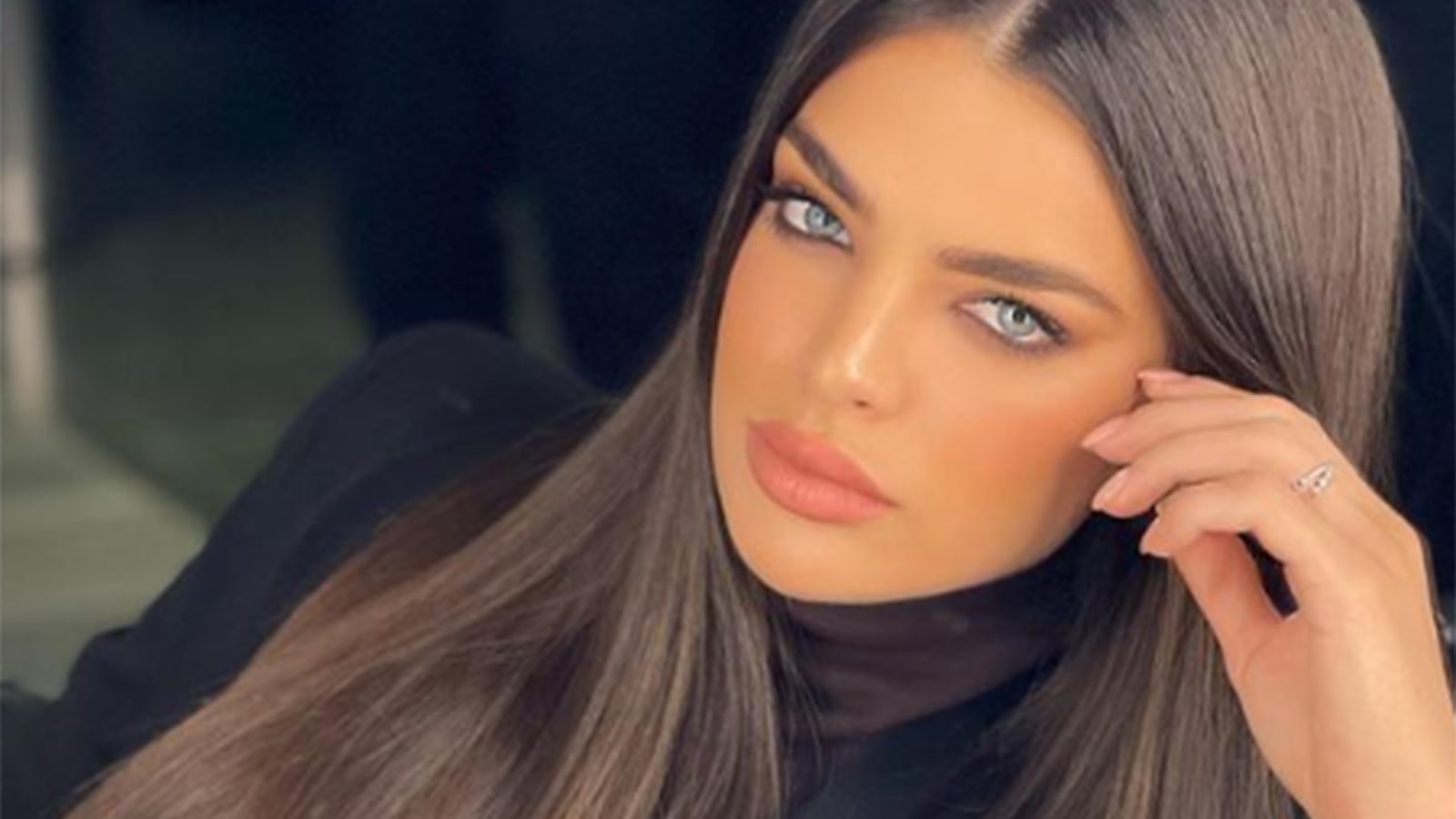 La sorprendente enfermedad con la que nació Nadia Ferreira.