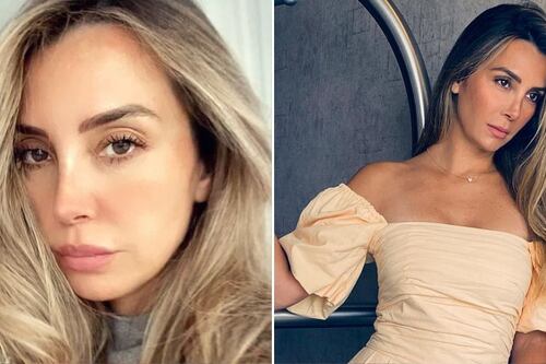 Elizabeth Gutiérrez revela el tratamiento estético que la hace lucir 10 años menor y puedes copiar