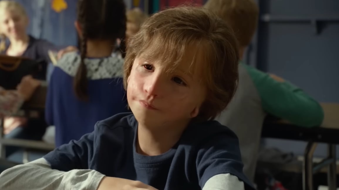 Más allá de las diferencias: qué es el síndrome de Treacher Collins y las historias que nos enseñan a mirar con empatía