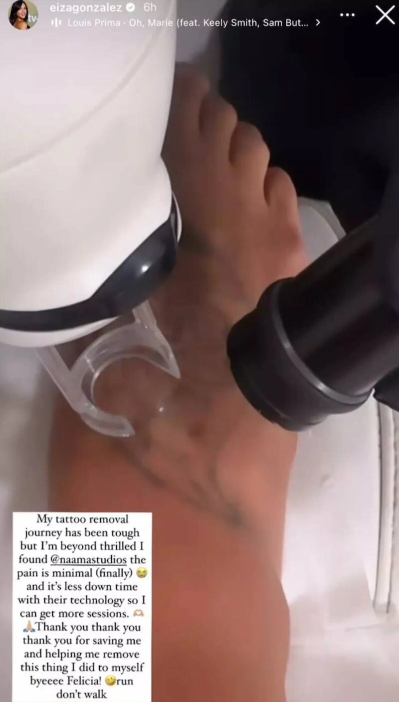 Eiza González comparte detalles de su procedimiento para eliminar uno de sus tatuajes
