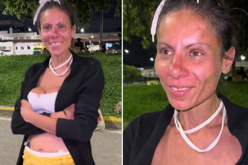 Karina, exmodelo de Stock Models que vivía en la calle, fue internada en centro de rehabilitación