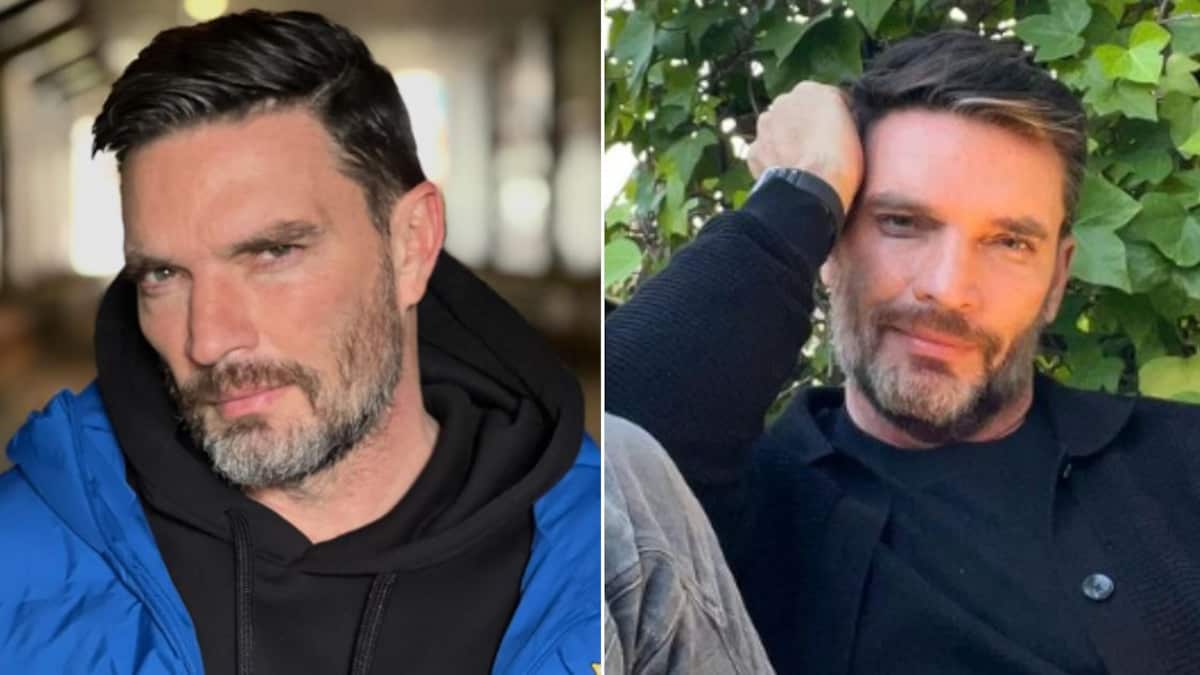 “Aún así se ve hermoso”: Julián Gil aparece sin dientes y preocupa a los fans, esto le sucedió