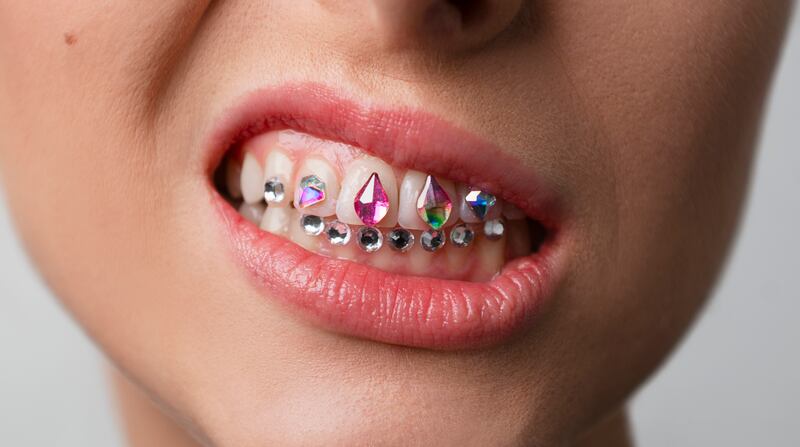 Piercings dentales