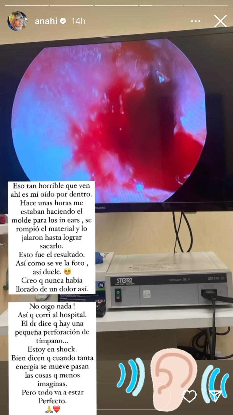Anahí accidente de tímpano.