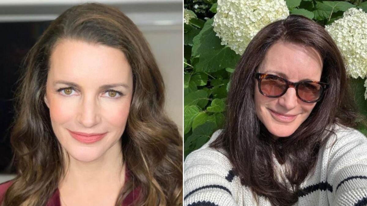 "Fui ridiculizada sin piedad": el impactante cambio de actriz de Sex and the City tras quitar los rellenos de su rostro