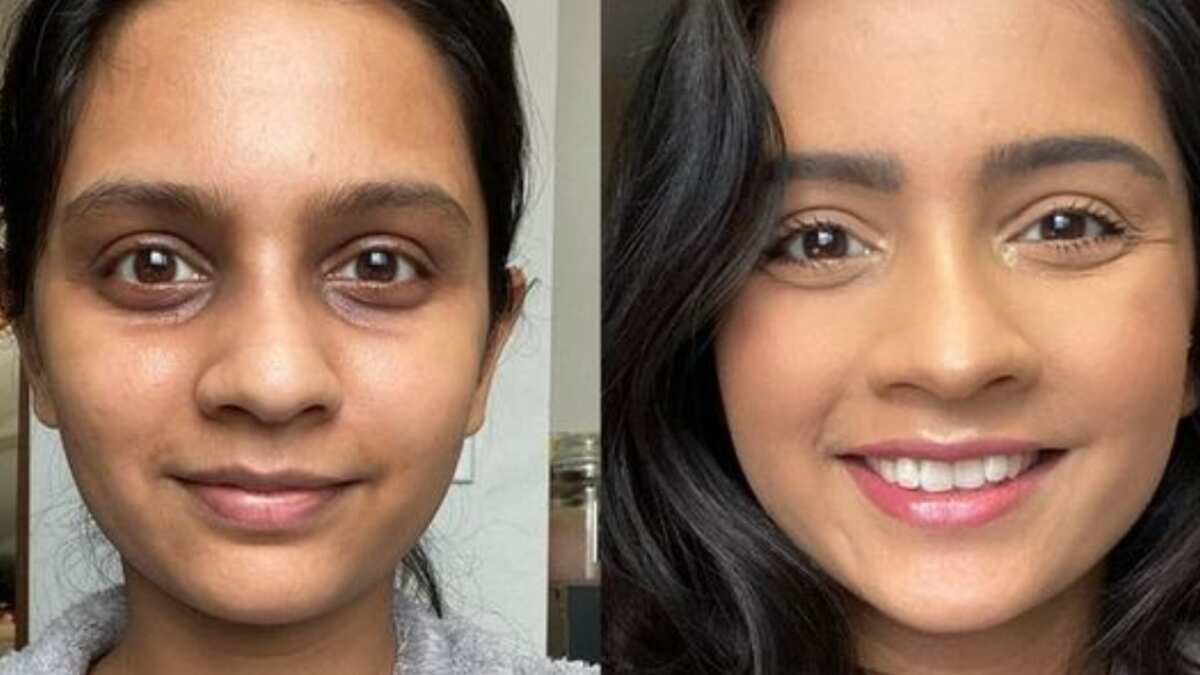 Trucos de maquillaje para manchas y acné