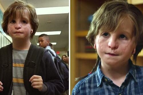 Así luce el niño de ‘Wonder’ sin maquillaje: tomaba más de una hora su transformación