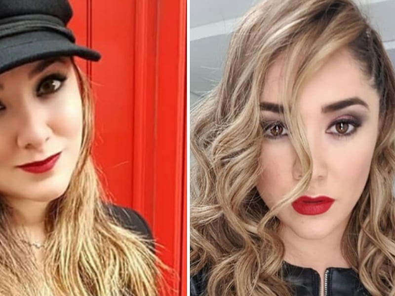 ¡7 kilos menos y un cambio radical! Sherlyn reaparece y sorprende por su transformación física