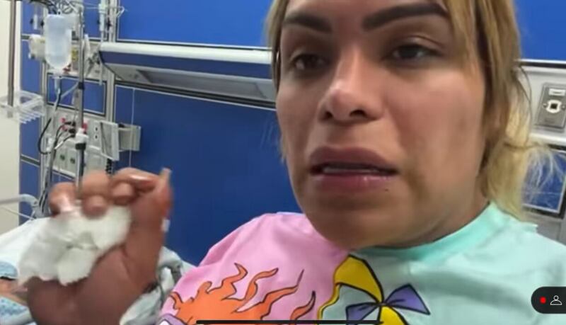 Dio a conocer que Paola Suárez tenía un hematoma y lesión en el tabique nasal. (Especial)