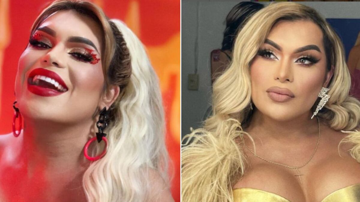 ¡Sin miedo al éxito! A Wendy Guevara no le importan los riesgos y se haría una queratopigmentación ¿Qué es?