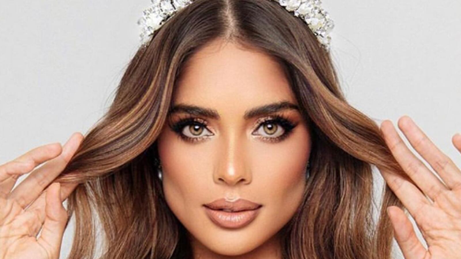 Aseguran que Miss Colombia se envejeció luego de hacerse la bichectomía: “parece un esqueleto”.