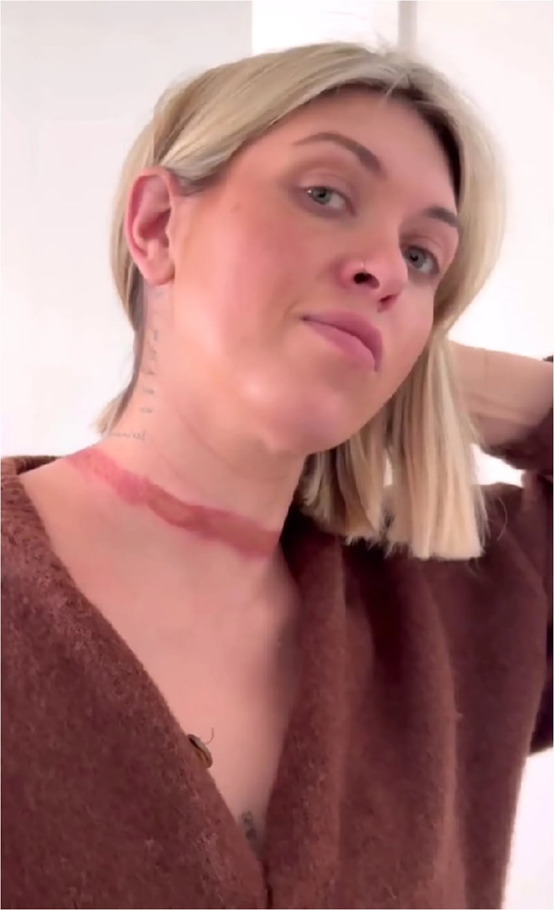 Viral