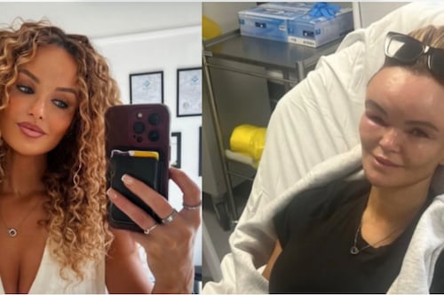 Mujer revela cómo comenzó enfermedad que deformó su rostro tras el estrés: impactantes imágenes