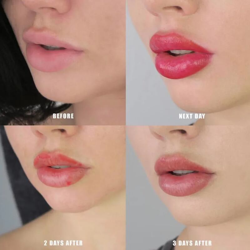 Lip blushing