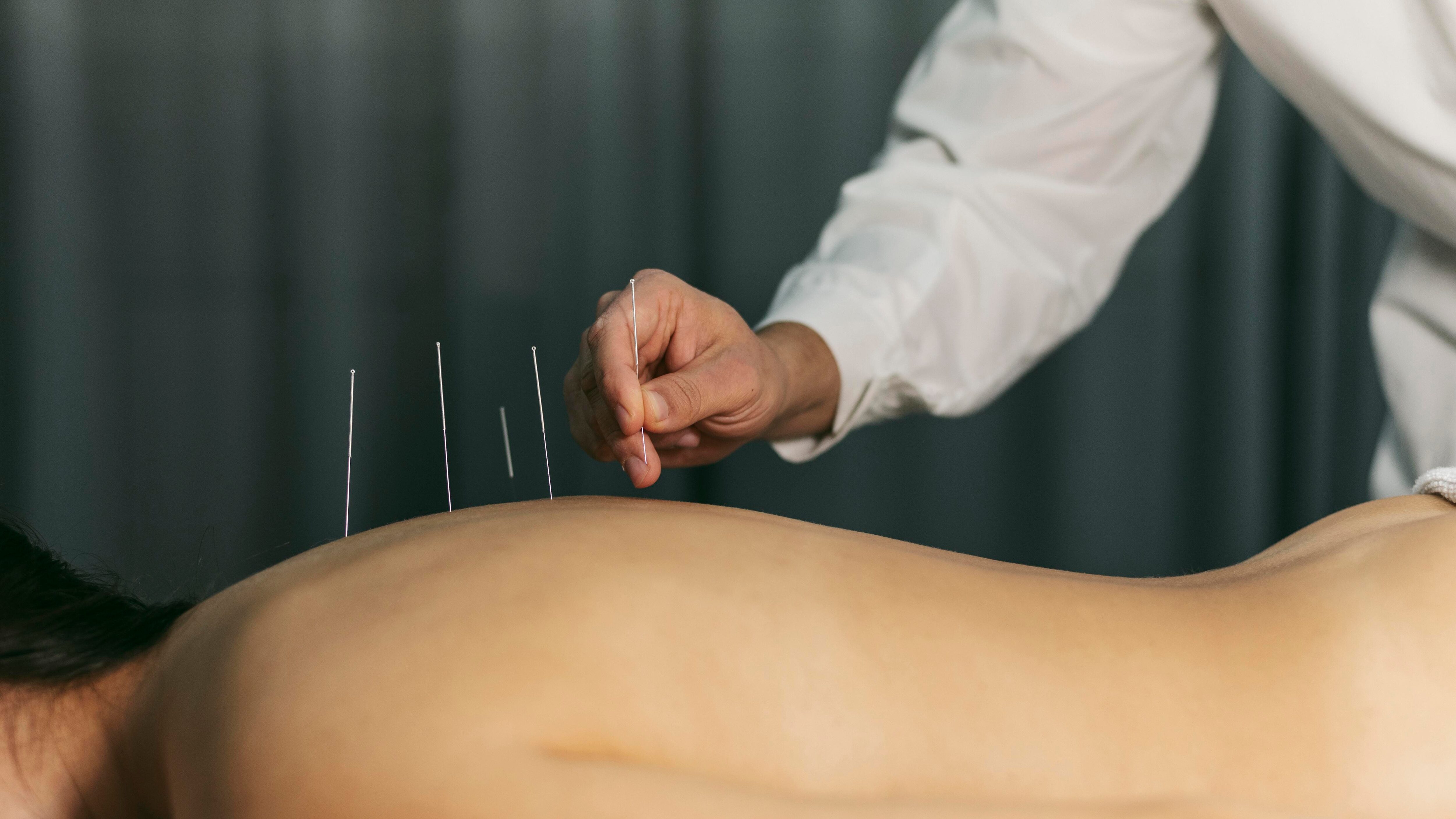 Acupuntura ayuda a la fertilidad.