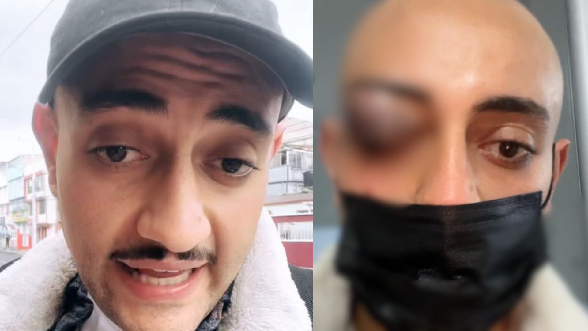 Ibrahim Salem, comediante que hizo burla ha atentado a escuela de Policía, sufrió aparatoso accidente en Bogotá