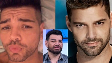 Hombre se operó más de 30 veces para parecerse a Ricky Martin y le inyectaron aceite de motor - Foto de la web