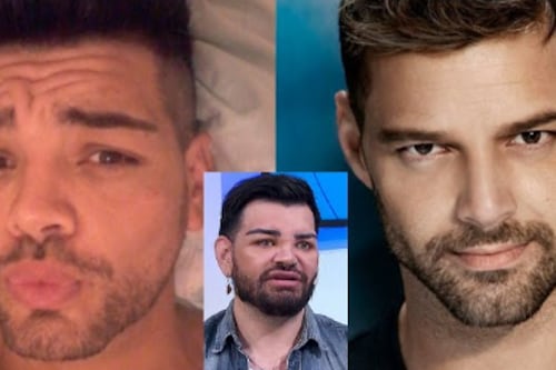 Hombre se operó más de 30 veces para parecerse a Ricky Martin y le inyectaron aceite de motor