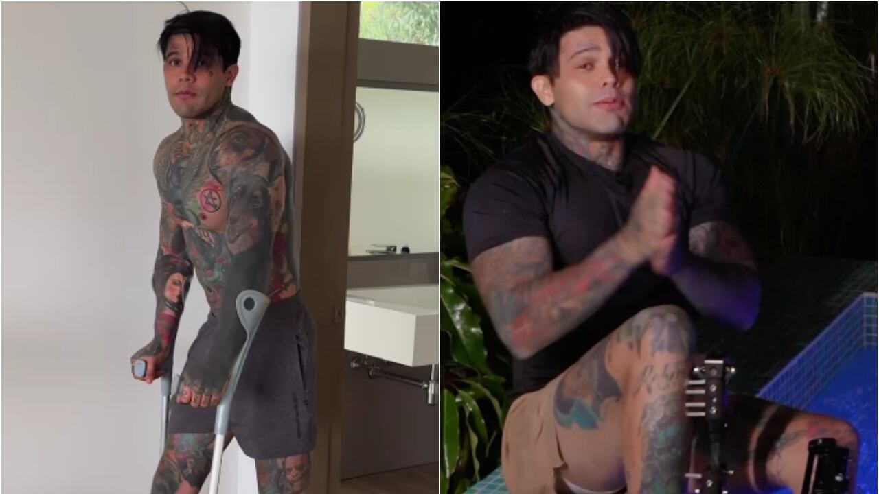 Yeferson Cossio sigue recuperándose de su cirugía para aumentar su estatura.