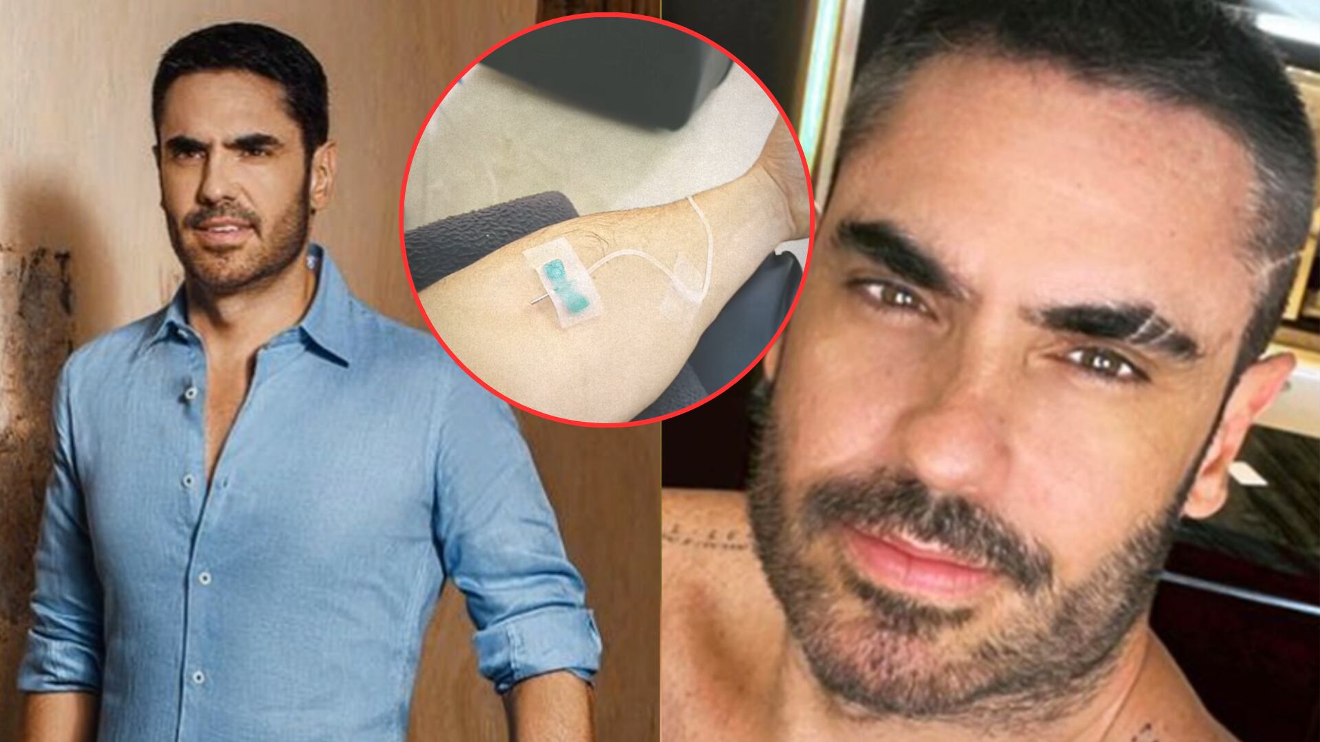 Tratamiento de Lincoln Palomeque para su nutrición