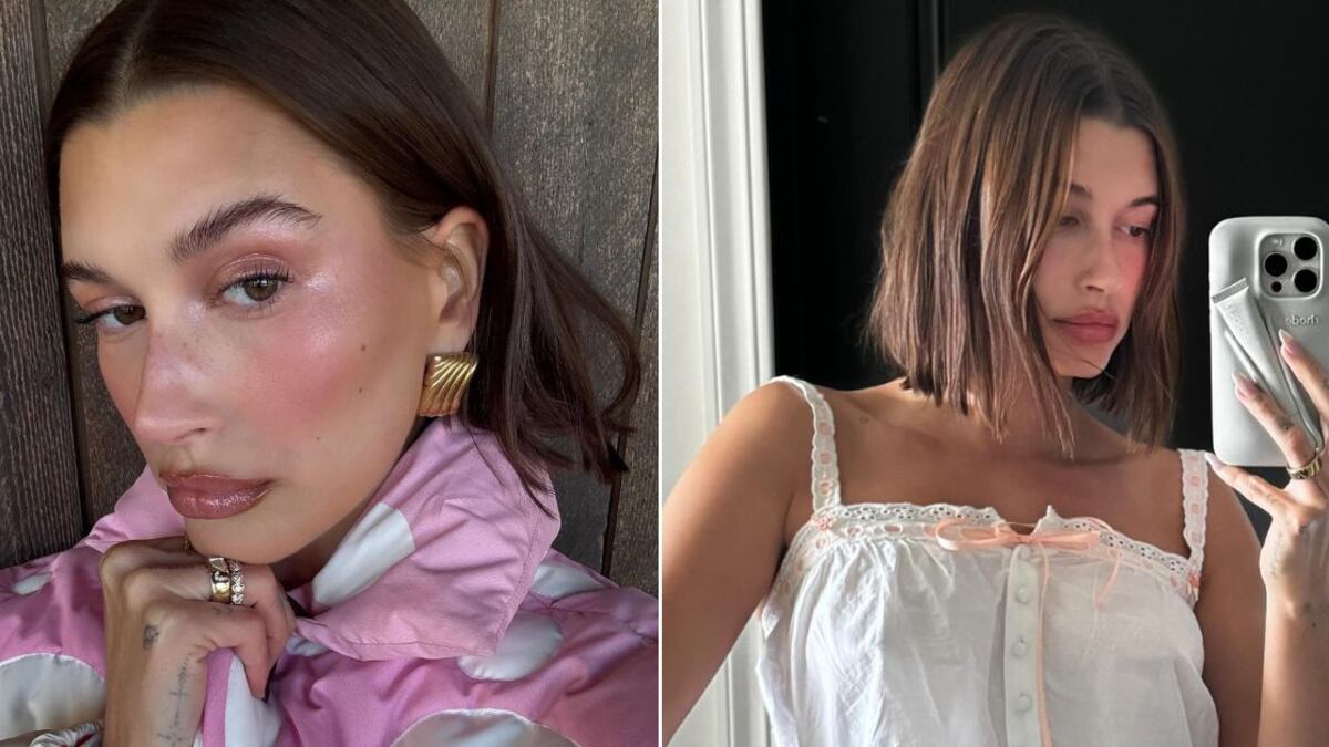 Hailey Bieber se sinceró con sus seguidores sobre su experiencia con la dermatitis perioral