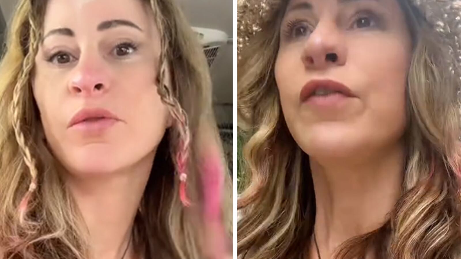 Regia, pero damnificada: mujer vendió su casa para hacerse cirugía plástica.