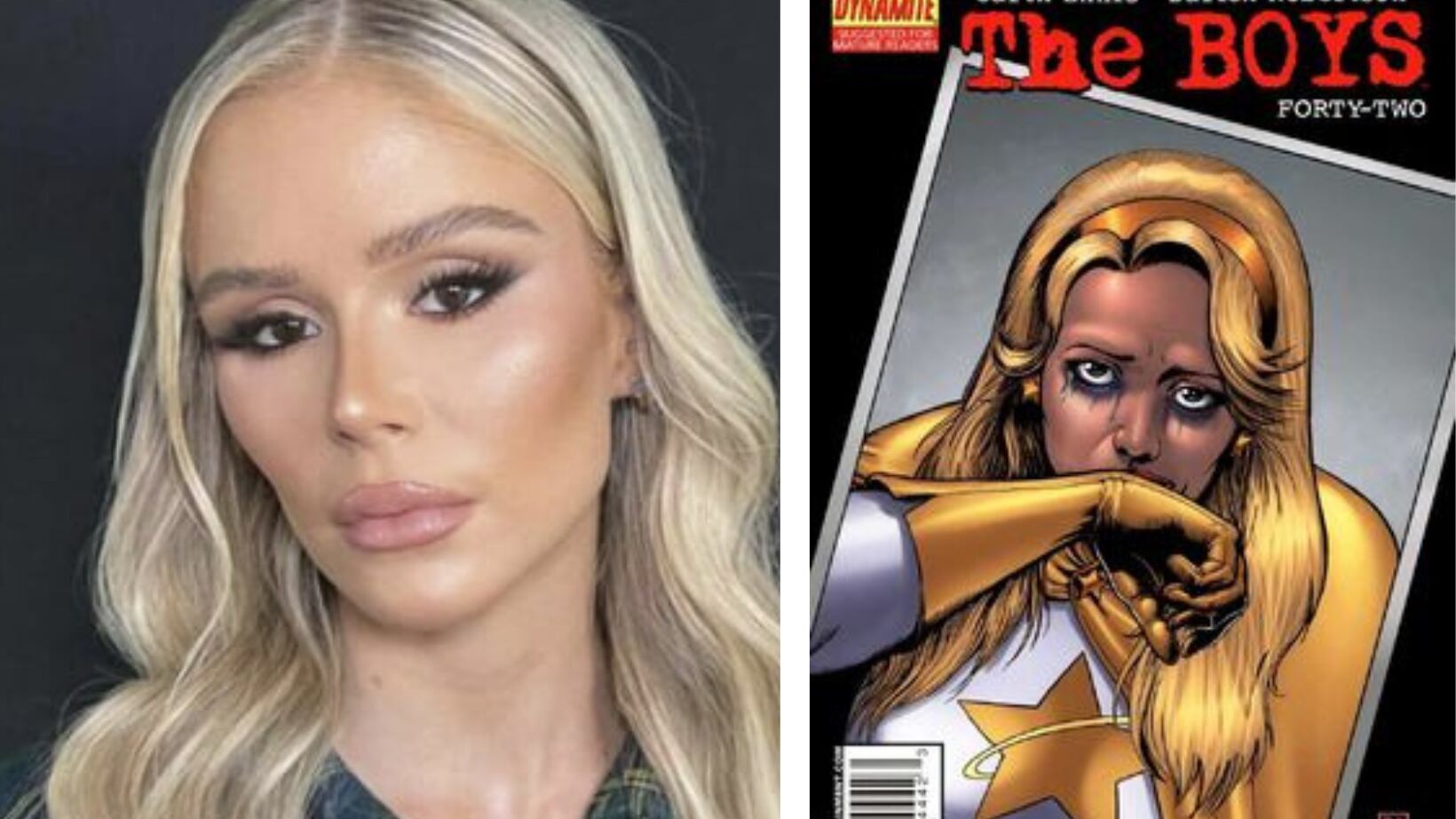 La triste razón por la que Erin Moriarty de The Boys cambio su cara