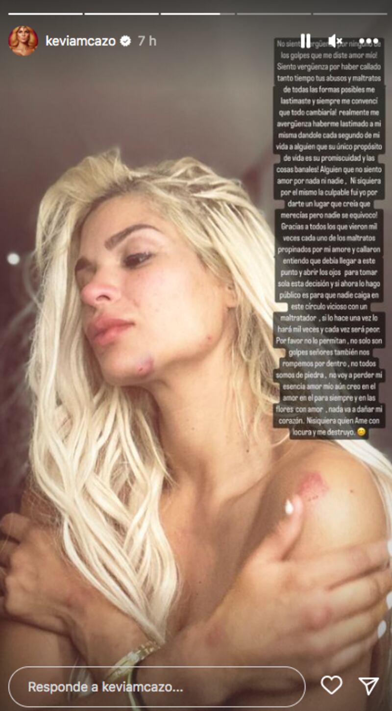 Captura de pantalla Instagram: @keviamcazo