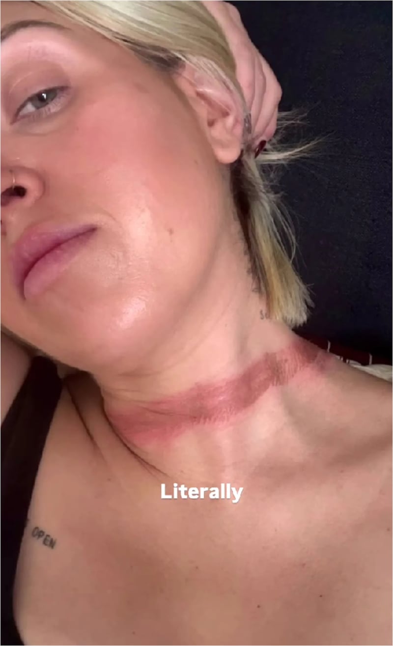 Viral