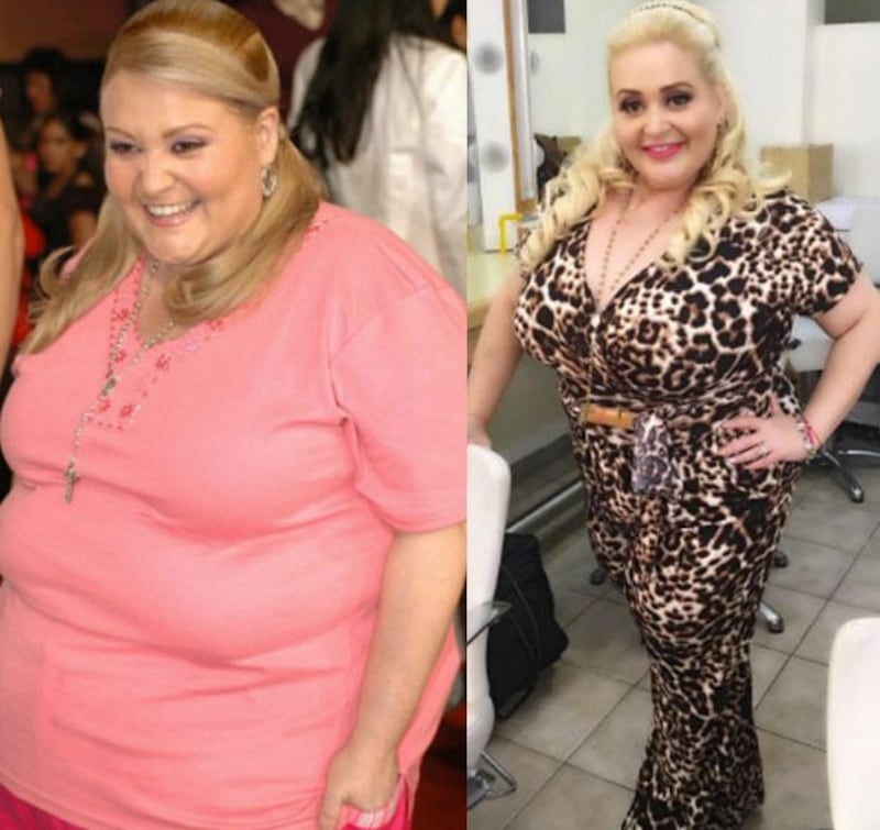 Sheyla (antes y después)