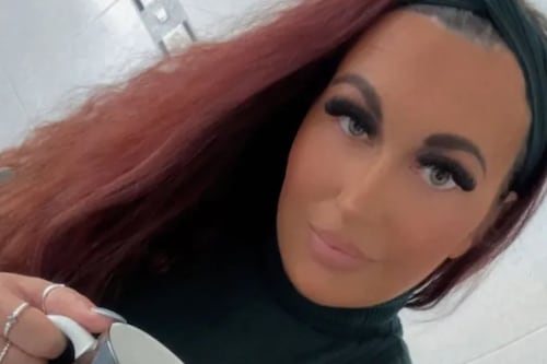 Mujer descubrió un tumor cerebral tras retirarse sus pestañas postizas de gran tamaño