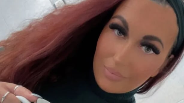 Mujer descubrió un tumor cerebral tras retirarse sus pestañas postizas de gran tamaño - Fuente: Foto de la web