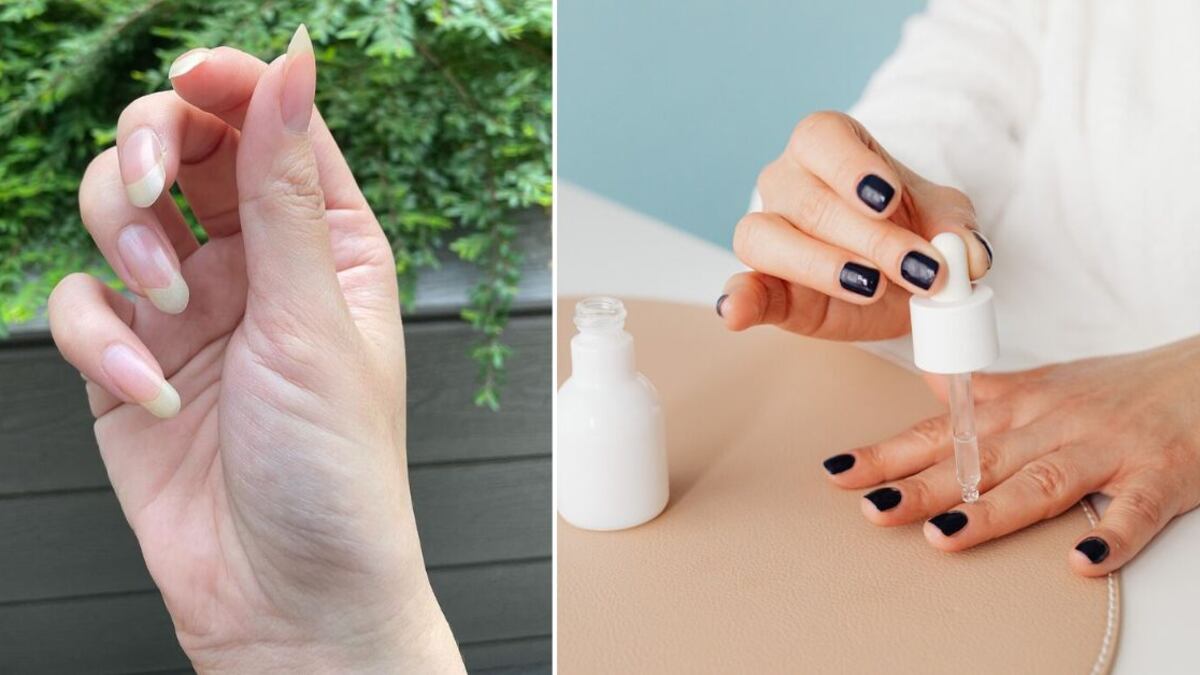 La hidratación es clave para recuperar la salud de las uñas