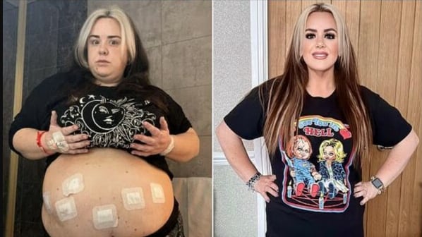 Llegó a pesar 115 kilos por depresión.