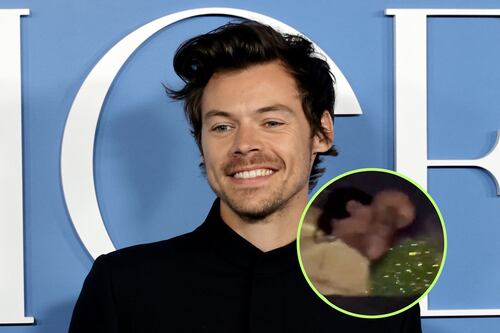 Golpean a Harry Styles en el ojo durante uno de sus conciertos