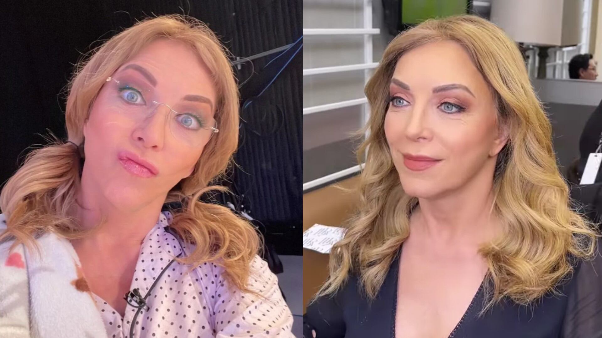 Laura Flores nos inspira al mostrarse al natural: se quitó la peluca y así luce