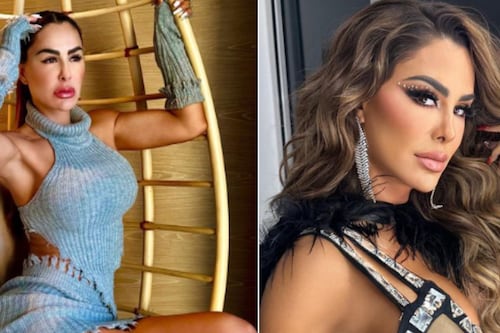 Llueven críticas a Ninel Conde por cómo se ve su rostro después de supuestos excesivos tratamientos faciales