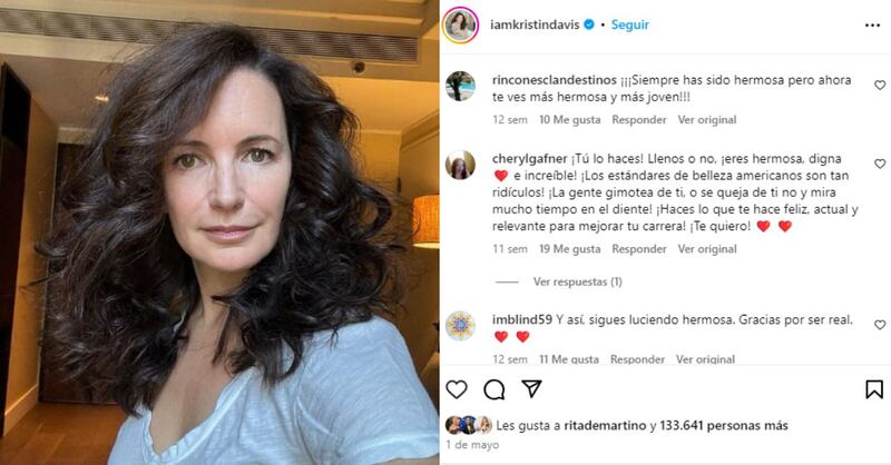 "Fui ridiculizada sin piedad": el impactante cambio de actriz de Sex and the City tras quitar los rellenos de su rostro
