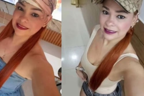 ¿Qué es ‘La Mela’? el procedimiento estético que llevó a la muerte a una mujer de 40 años dejándole terribles heridas