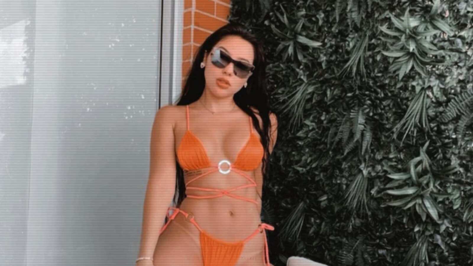 Aida Victoria Merlano y su ecografía para aclarar que no tiene biopolímeros.