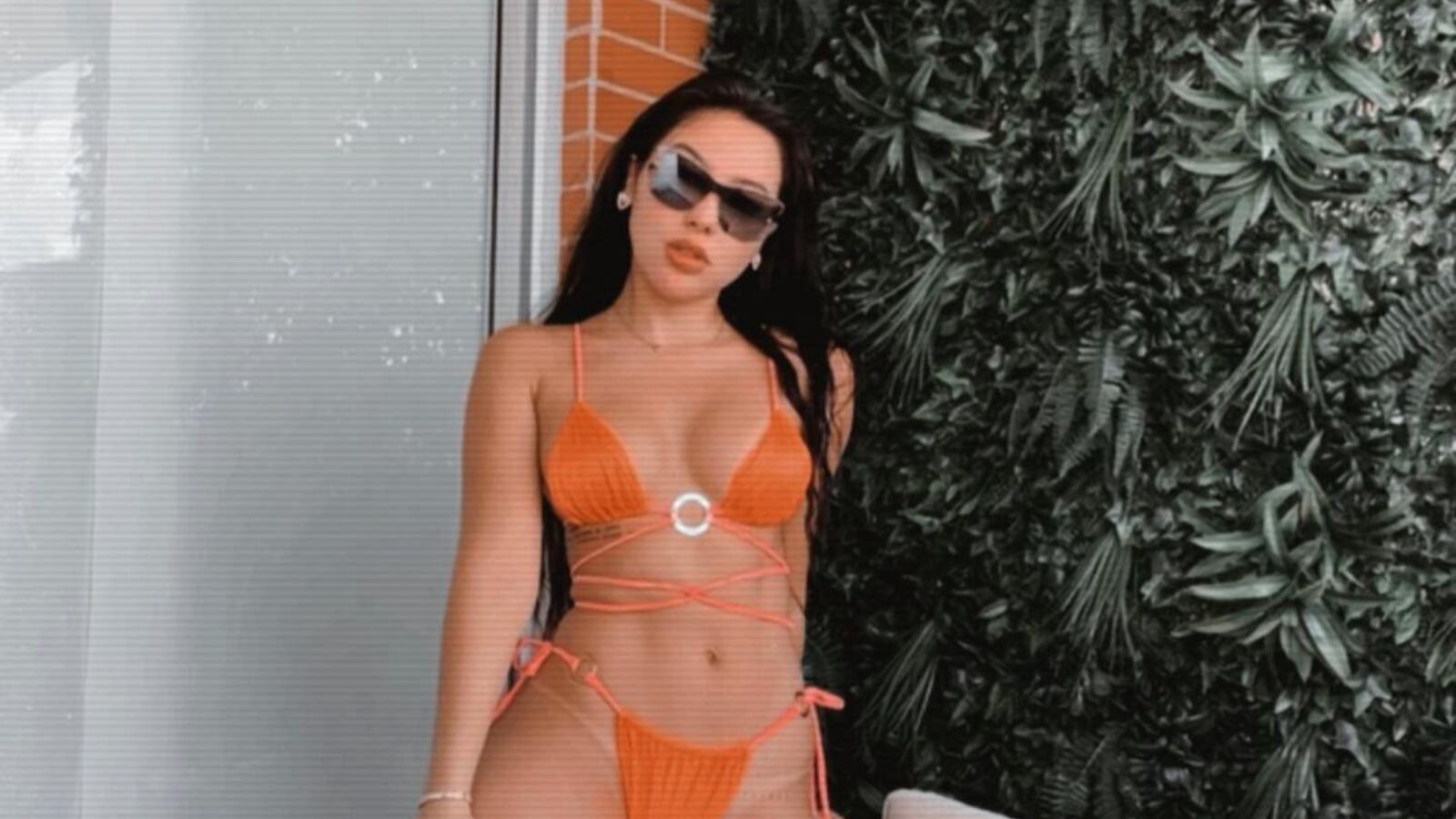 Aida Victoria Merlano y su ecografía para aclarar que no tiene biopolímeros.