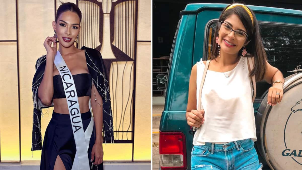 Estos son los cambios estéticos que Sheynnis Palacios se hizo para lucir más bella.