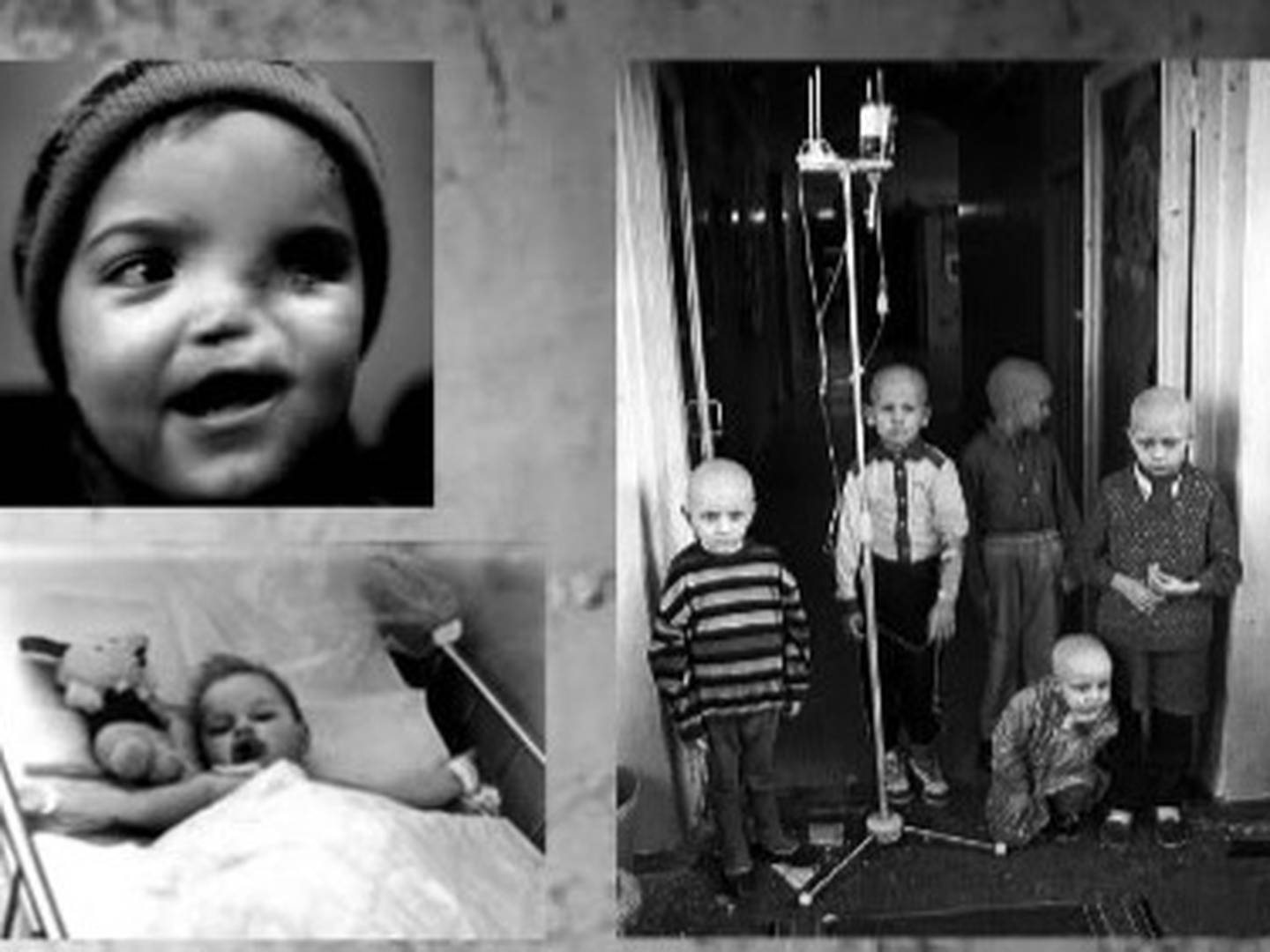 Los niños de Chernobyl - VeoVerde
